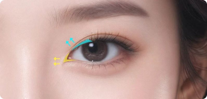 eye-2-5