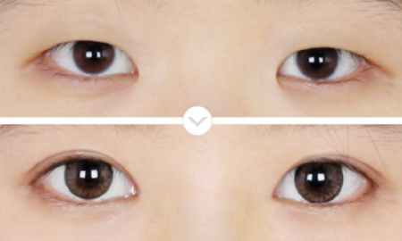 eye-2