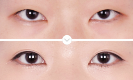 eye-4