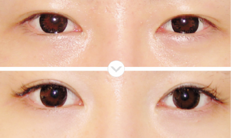 eye-6