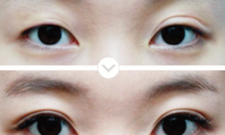 eye-7