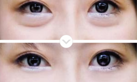 eye-8