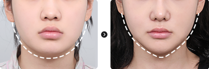 face-1-4