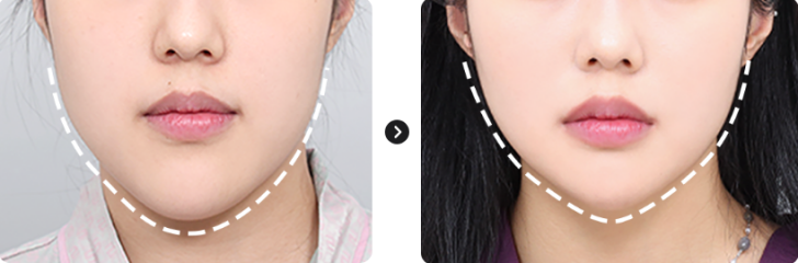face-1-5