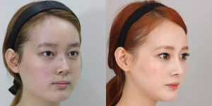 nose3-3